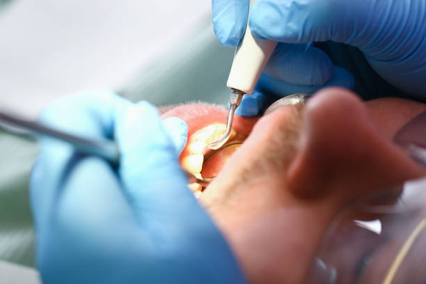 Best Emergency Treatment for Toothache in Lordstown, OH